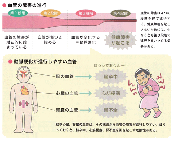 血管障害の進行